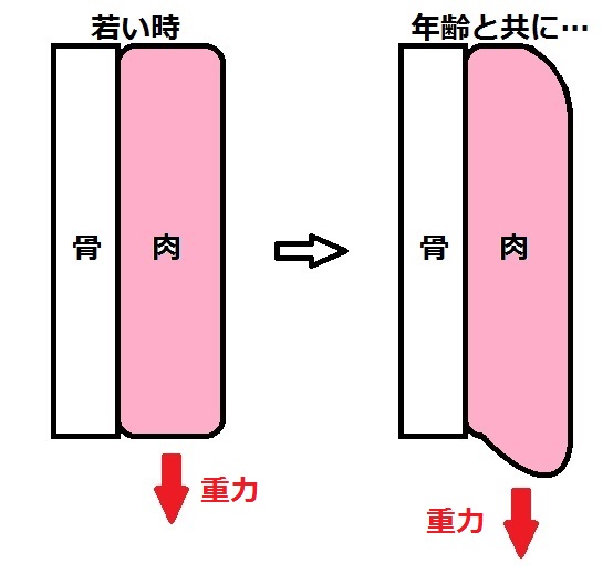 たるみ模式図.jpg