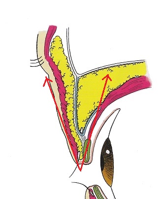 上瞼の厚み.jpg