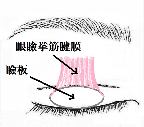 眼瞼挙筋腱膜.jpg