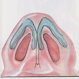 鼻尖画像1.jpg