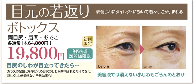 201512-botox-670.jpg