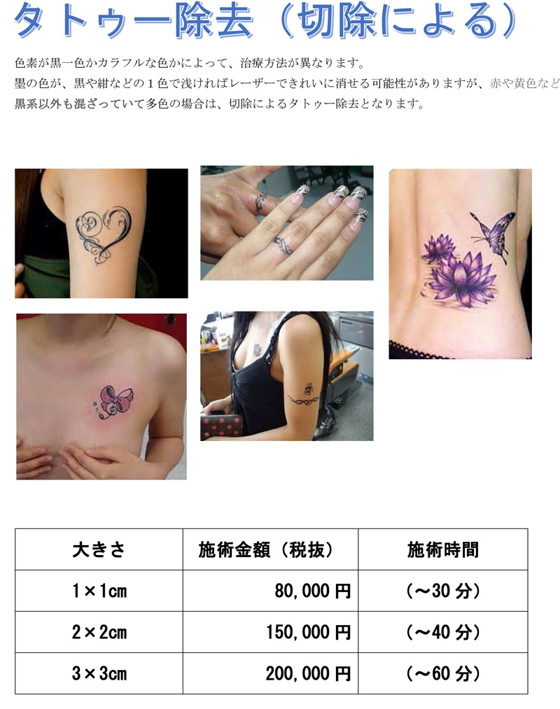 tatoo-jyokyo-s.jpg