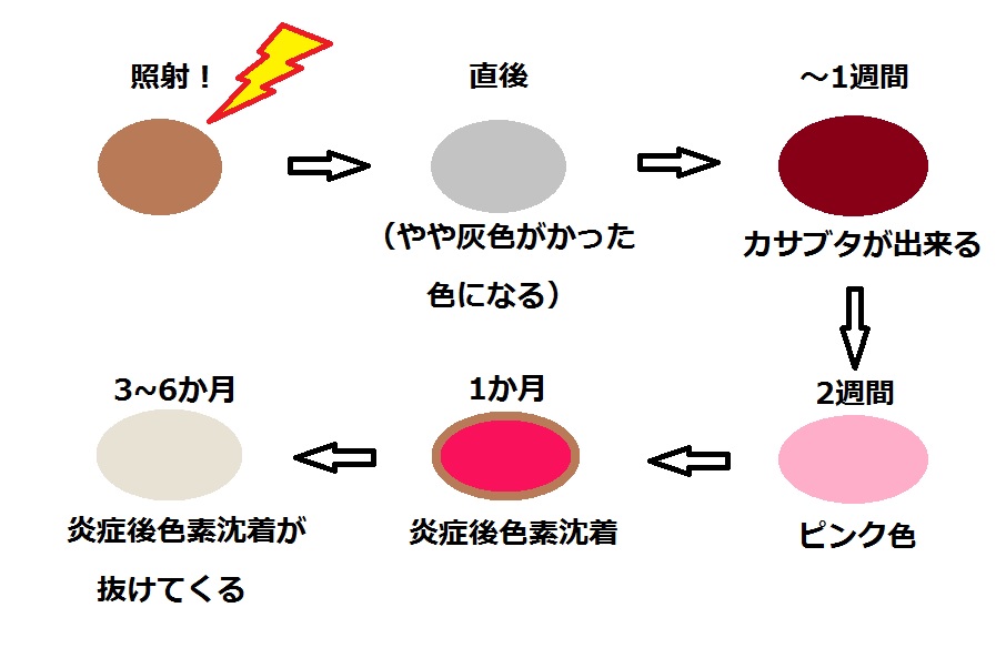 シミ治療経過.jpg