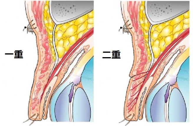 二重の構造と切開法二重の仕組み 奈良 東大阪 京都 三重 和歌山 美容外科 美容皮膚科 奈良ピュアメディカルクリニック