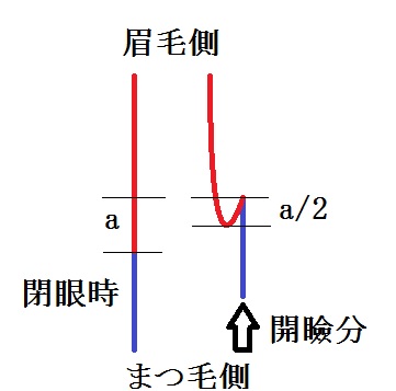 上瞼たるみ取りの理屈.jpg