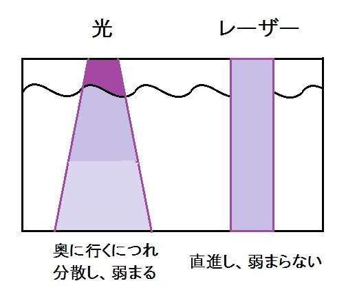 光VSレーザー脱毛.jpg