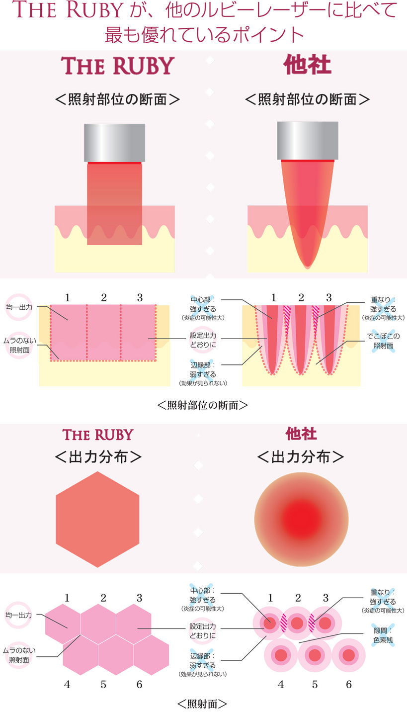 奈良のシミ取り治療　は美容外科皮膚科ピュアメディカルクリニック