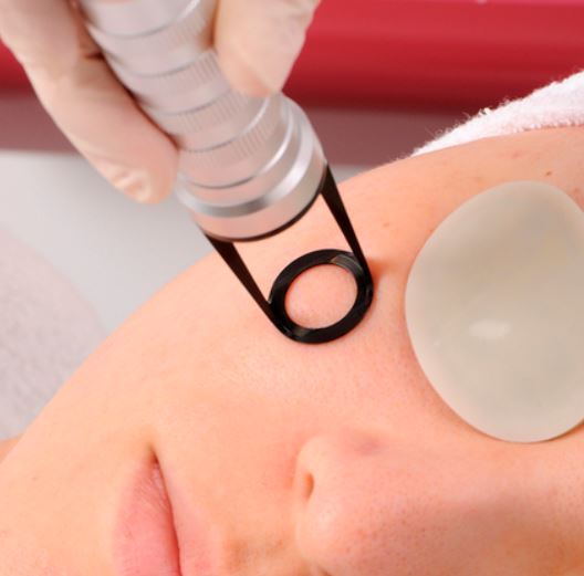 奈良のシミ取り治療　美容外科皮膚科ピュアメディカルクリニック