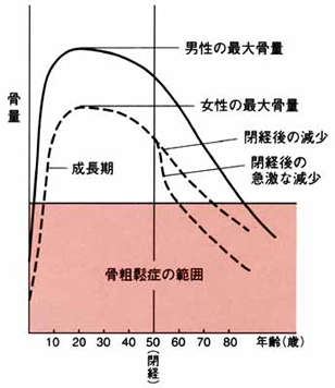 年齢と骨量.jpg