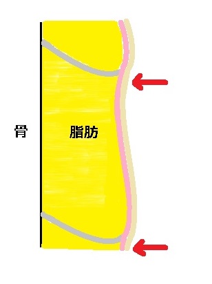 皮膚骨靭帯関係図タルミあり２.jpg