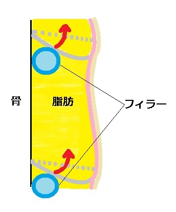 皮膚骨靭帯関係図タルミあり３.jpg