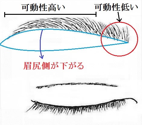 眉下切開の術後.jpg