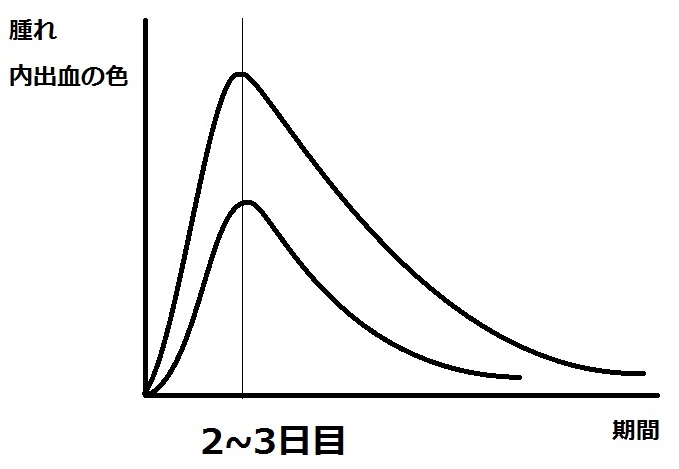 腫れと期間の関係.jpg