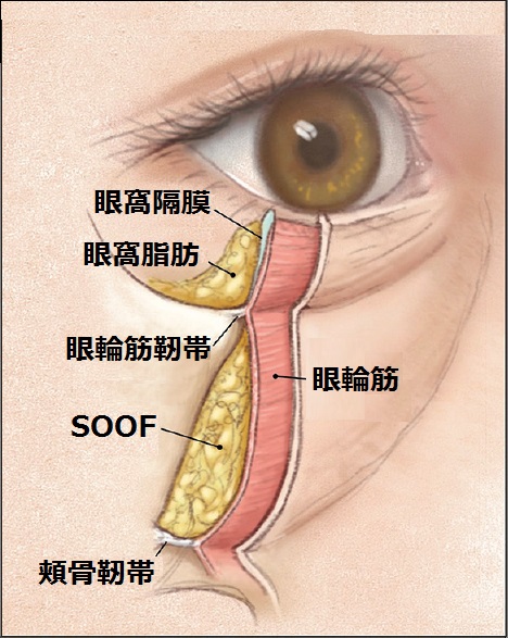 JCutanAesthetSurg_2016_9_2_65_184046_f1.jpg