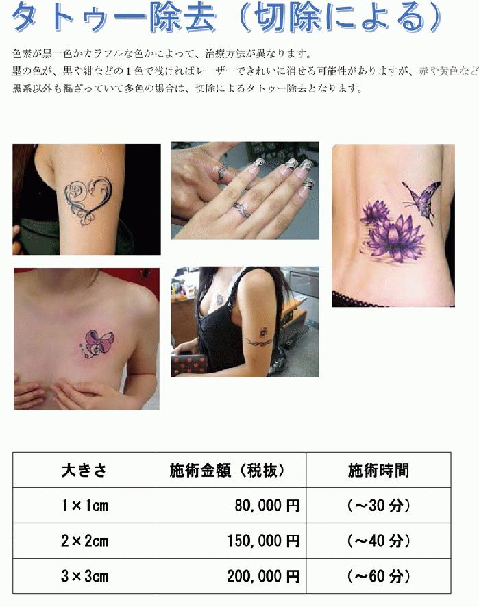 tatoo-jyokyo-s1.jpg