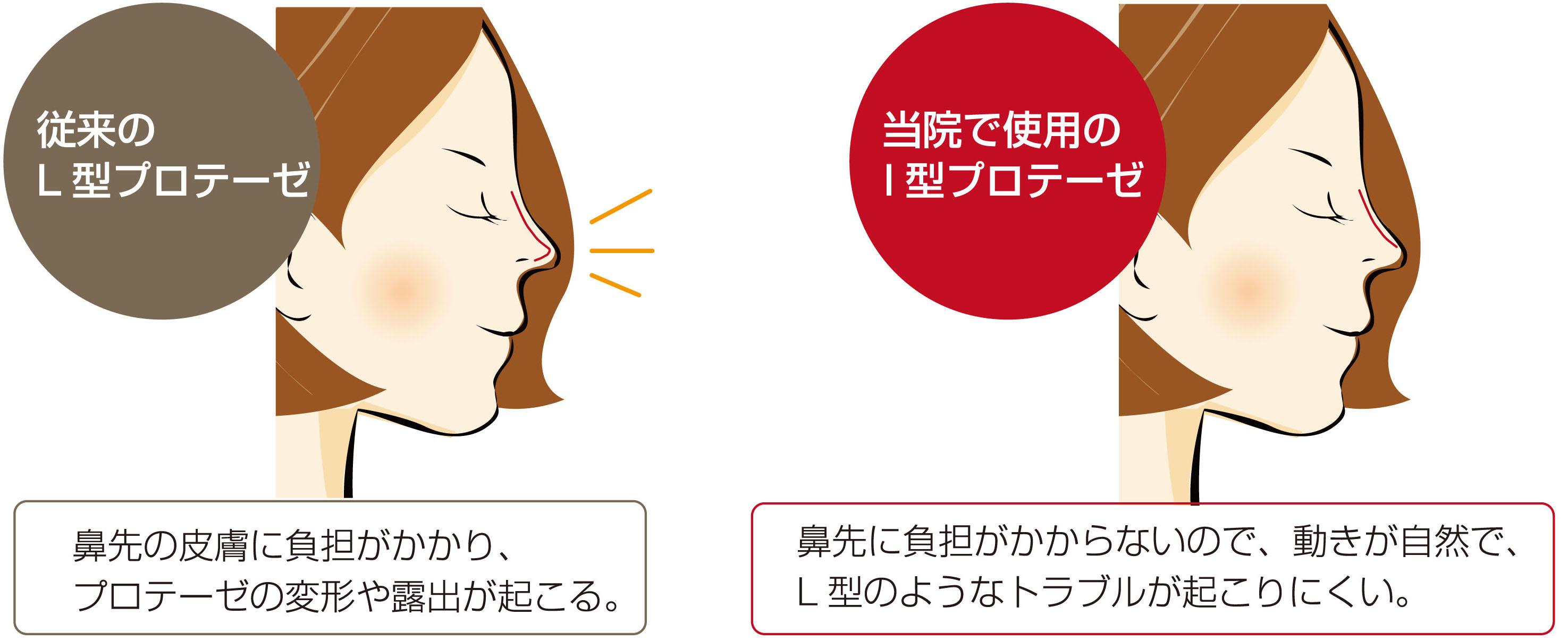 hana-igata2.jpg