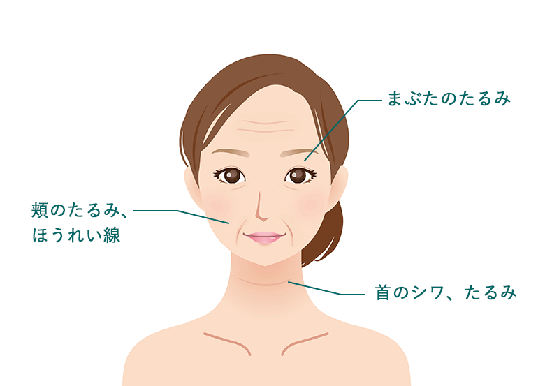 たるみイラスト