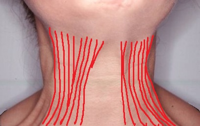 neck-bands-platysma.jpg