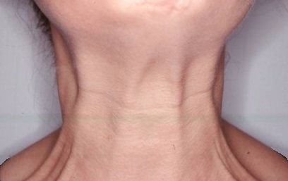 neck-bands.jpg