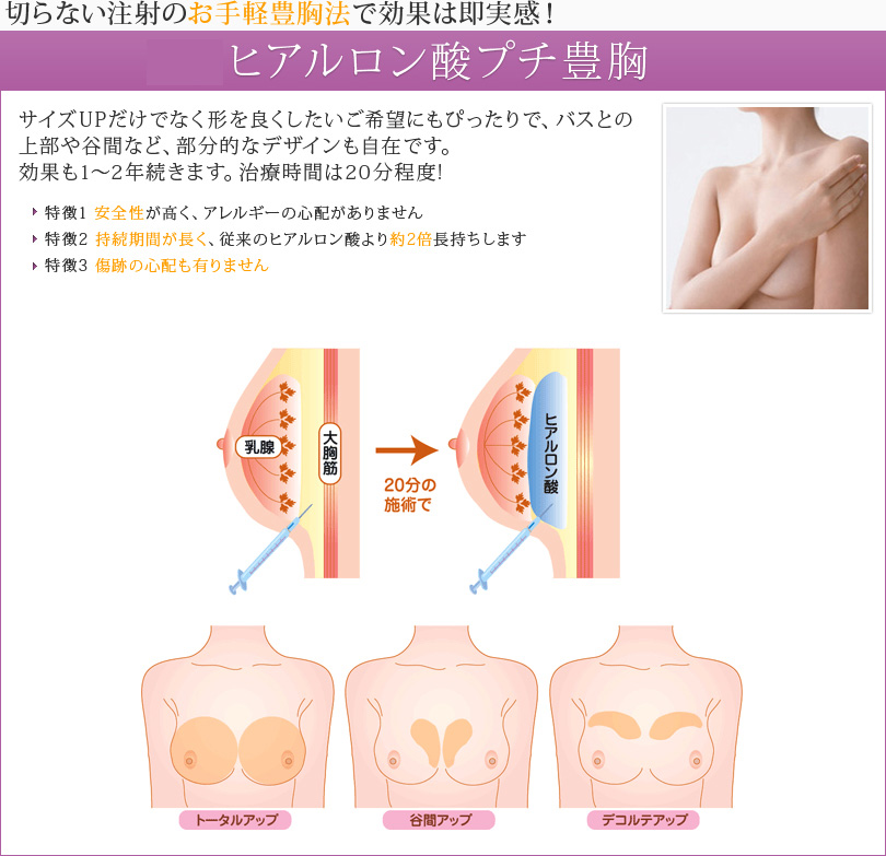 ヒアルロン酸のバスト豊胸｜美容外科皮膚科ピュアメディカルクリニック奈良橿原王寺