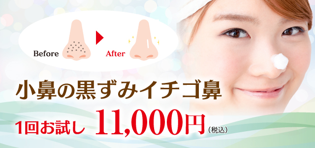 アグネス いちご鼻 美容外科皮膚科ピュアメディカルクリニック奈良 アグネス いちご鼻 美容外科皮膚科ピュアメディカルクリニック奈良