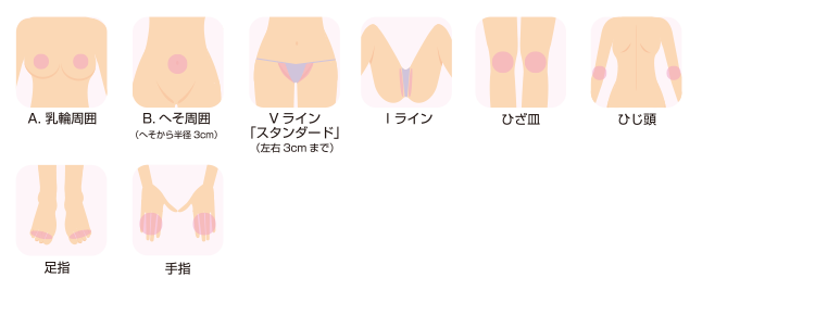 脱毛