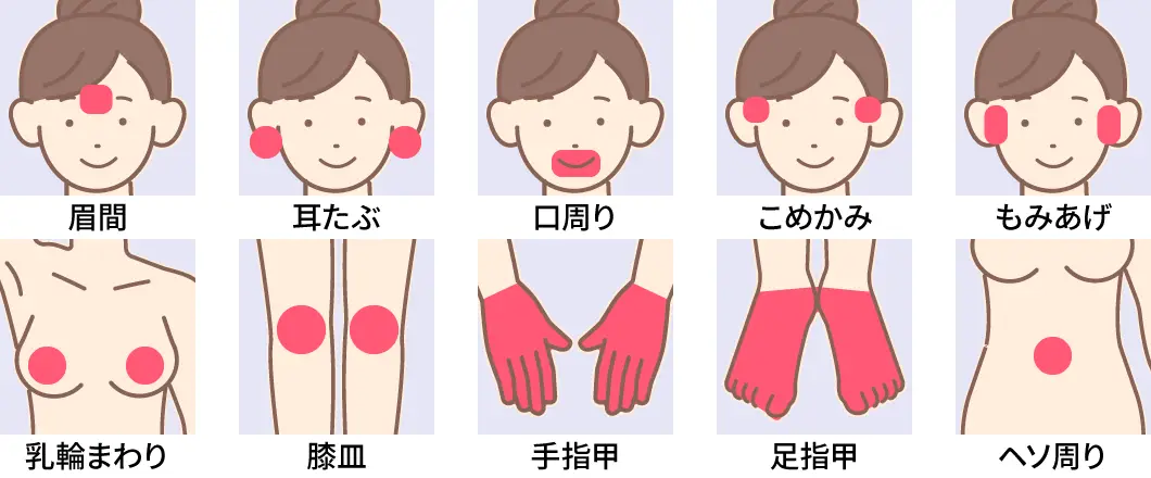 脱毛