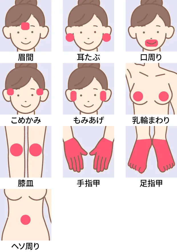 脱毛