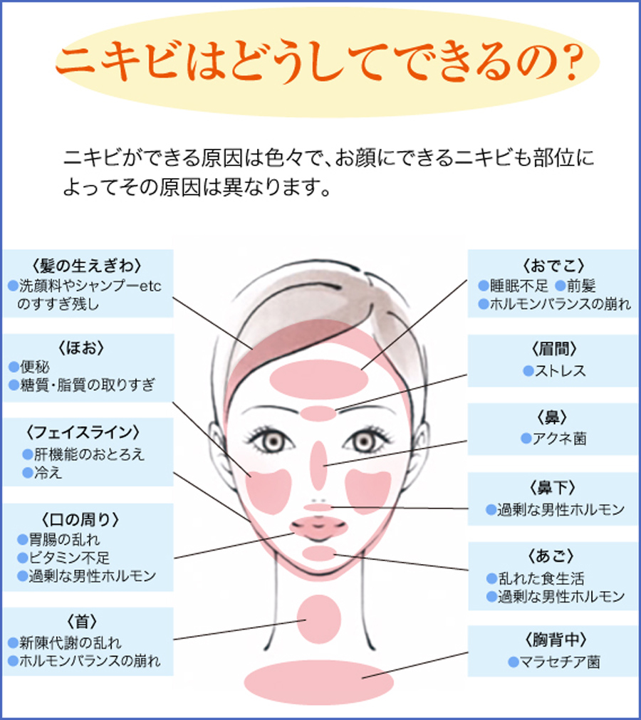 大人ニキビをどうしても解消したい 原因と解消方法 美容外科皮膚科ピュアメディカルクリニック奈良