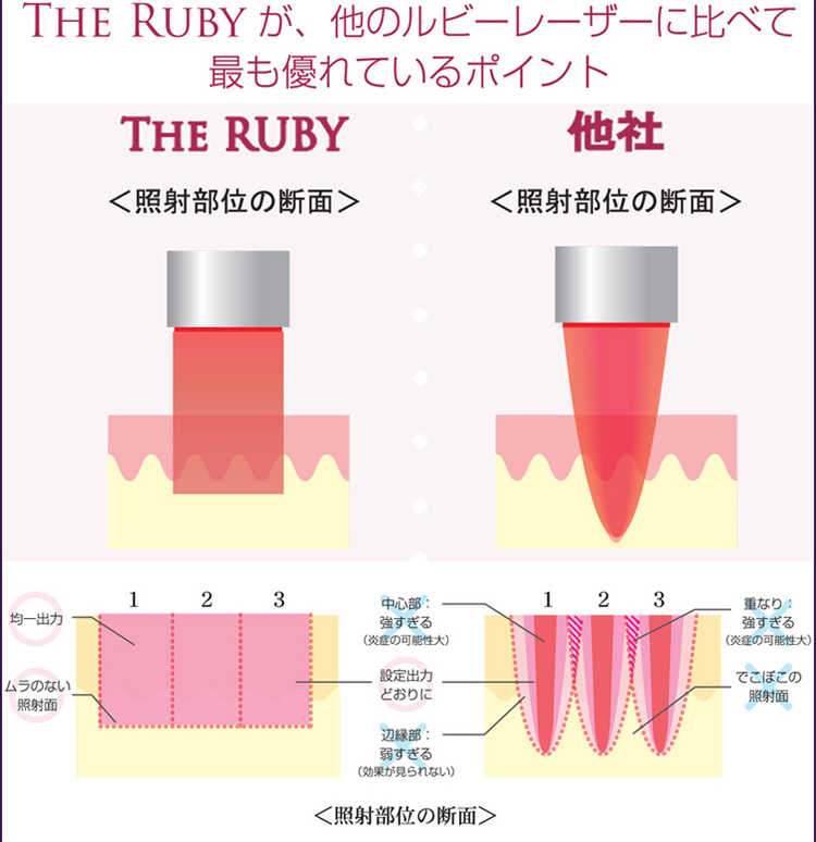 お顔身体のシミ肝斑取り治療｜美容外科皮膚科ピュアメディカルクリニック奈良西大寺王寺橿原3院