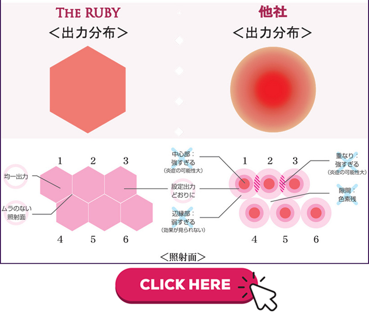 お顔身体のシミ肝斑取り治療｜美容外科皮膚科ピュアメディカルクリニック奈良西大寺王寺橿原3院