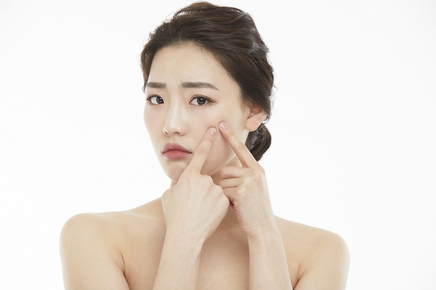 薬で治らない！繰り返すにきびの根本治療アグネス｜美容外科皮膚科ピュアメディカルクリニック奈良