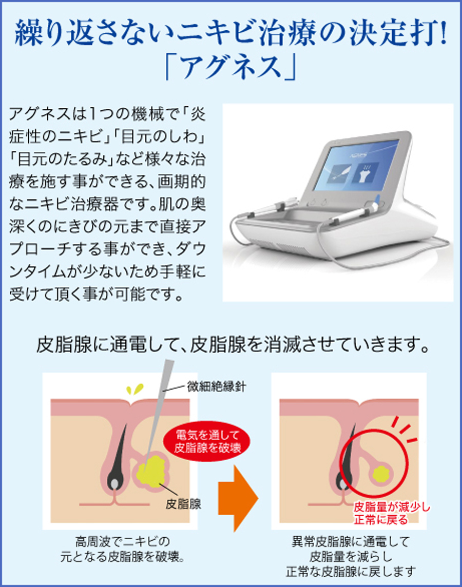 薬で治らない！繰り返すにきびのお悩みで口コミ評判アグネス｜美容外科皮膚科ピュアメディカルクリニック奈良