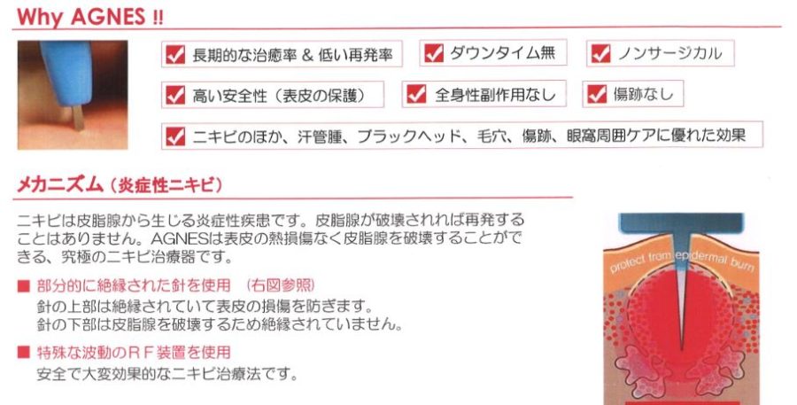 アグネス治療のメカニズム